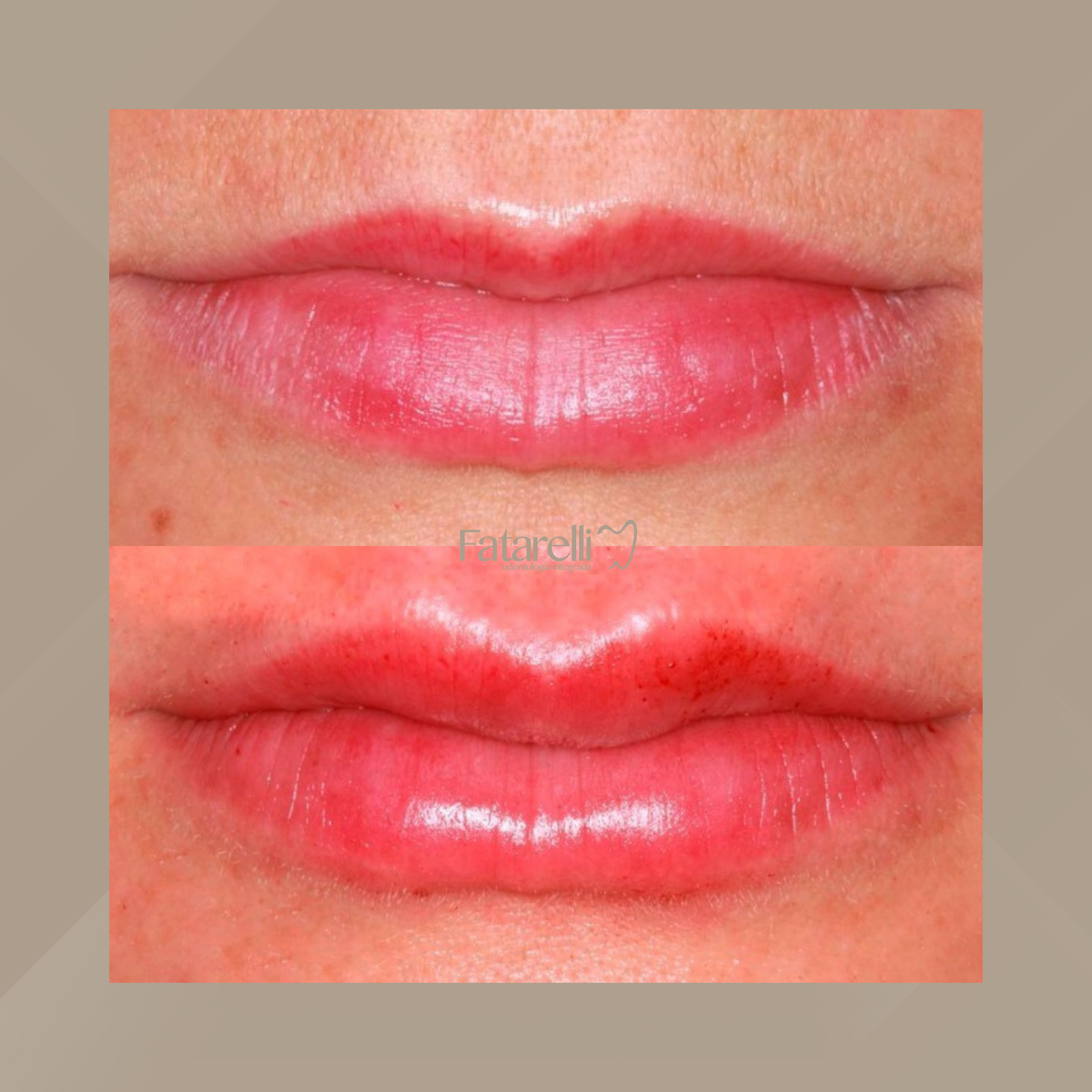 Fatarelli Odontologia Integrada. Harmonização Facial #1.1