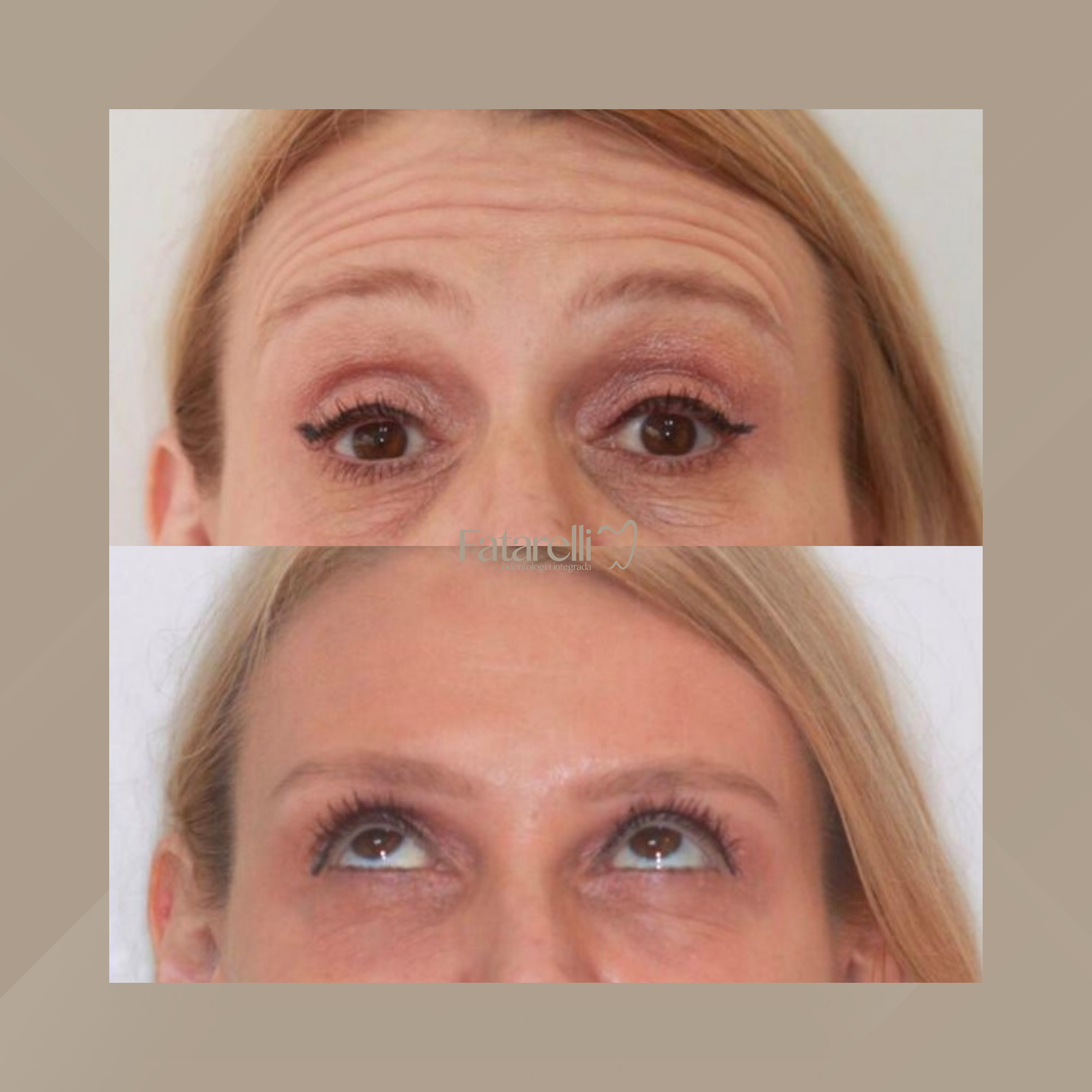 Fatarelli Odontologia Integrada. Harmonização Facial #2.1