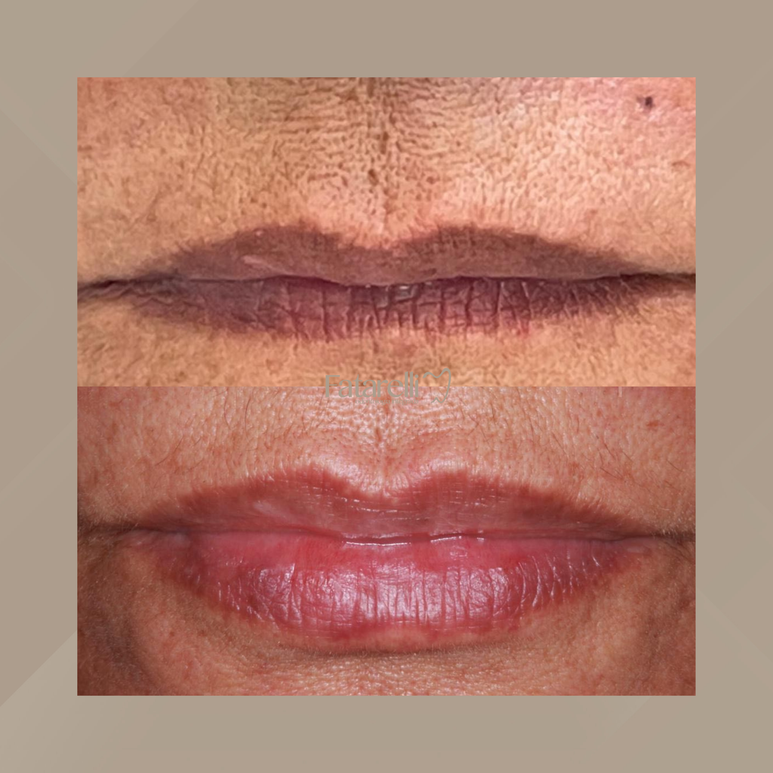 Fatarelli Odontologia Integrada. Harmonização Facial #3.1